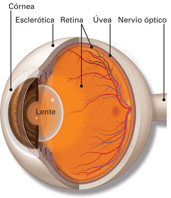 desprendimiento de retina