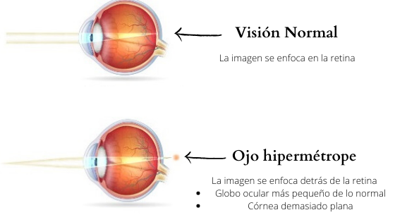 topografía